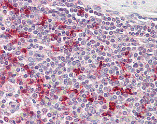 PTMA Antibody in Immunohistochemistry (Paraffin) (IHC (P))