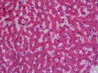 ITIH4 Antibody in Immunohistochemistry (Paraffin) (IHC (P))