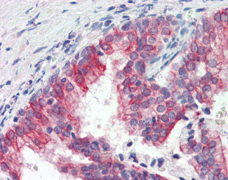 ROR1 Antibody in Immunohistochemistry (Paraffin) (IHC (P))