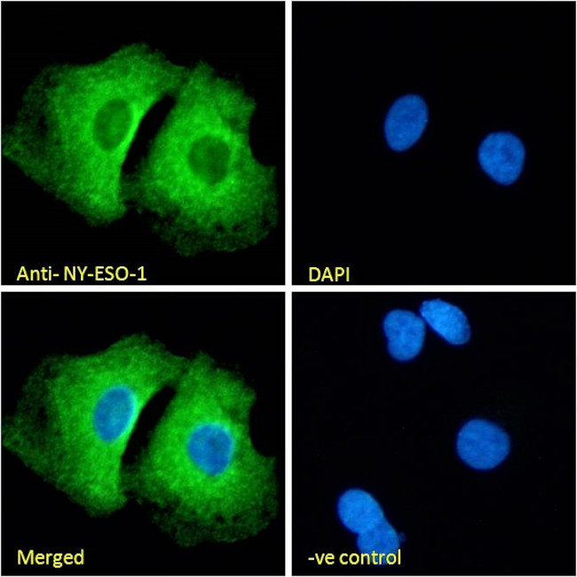 CTAG1B Antibody in Immunocytochemistry (ICC/IF)