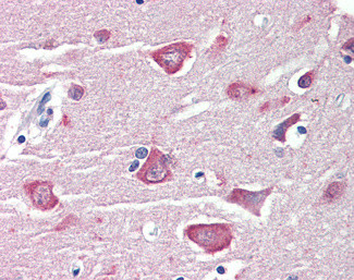 RASSF1 Antibody in Immunohistochemistry (Paraffin) (IHC (P))