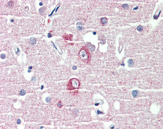 SAPAP1 Antibody in Immunohistochemistry (Paraffin) (IHC (P))