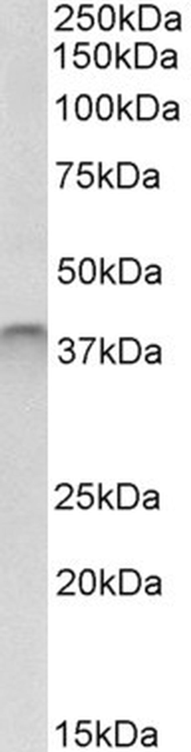 SPO11 Antibody in Western Blot (WB)
