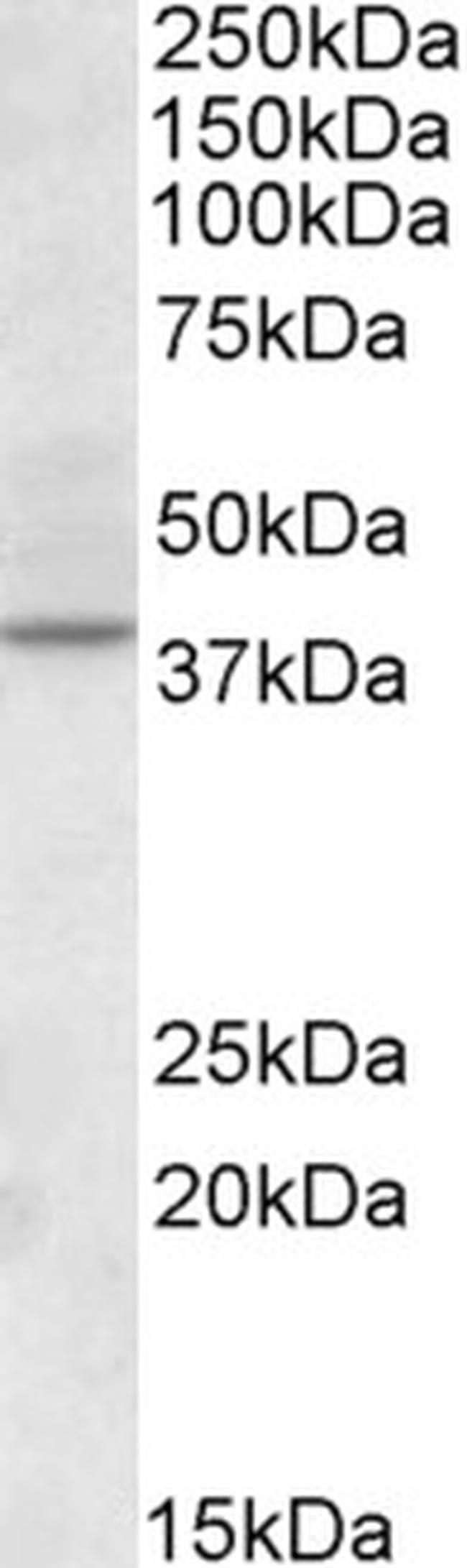 CDK10 Antibody in Western Blot (WB)