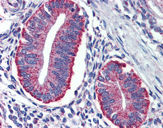 TYROBP Antibody in Immunohistochemistry (Paraffin) (IHC (P))