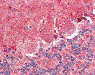 FABP7 Antibody in Immunohistochemistry (Paraffin) (IHC (P))
