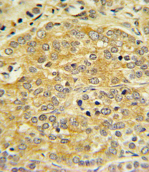 Apolipoprotein L1 Antibody in Immunohistochemistry (Paraffin) (IHC (P))