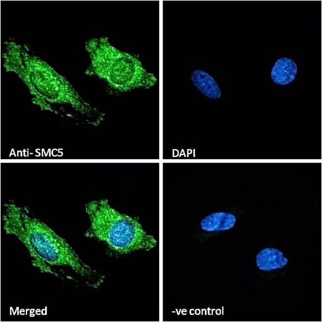 SMC5 Antibody in Immunocytochemistry (ICC/IF)
