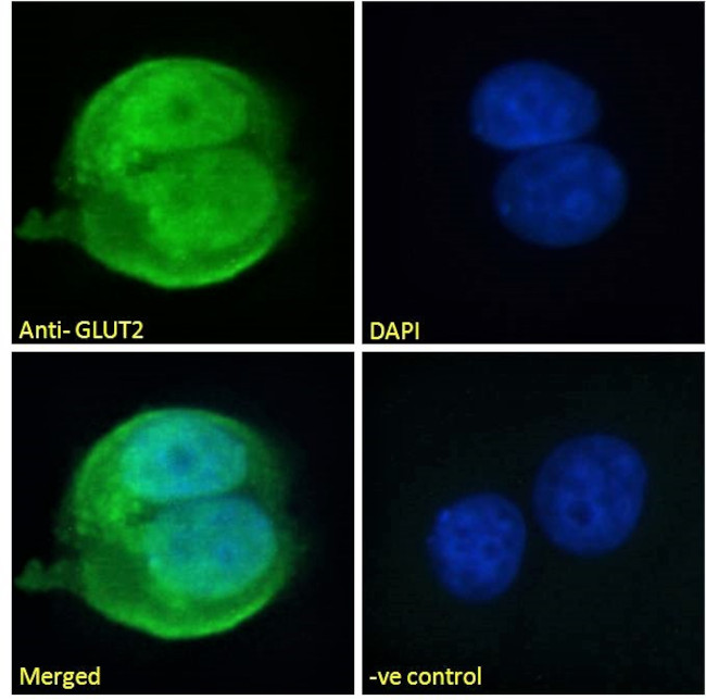 GLUT2 Antibody in Immunocytochemistry (ICC/IF)