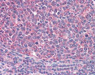 ICOS (CD278) Antibody in Immunohistochemistry (Paraffin) (IHC (P))