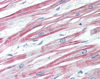 EPM2AIP1 Antibody in Immunohistochemistry (Paraffin) (IHC (P))