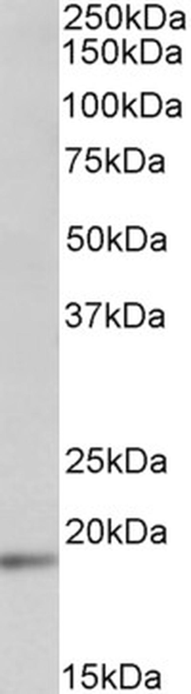 UBE2C Antibody in Western Blot (WB)