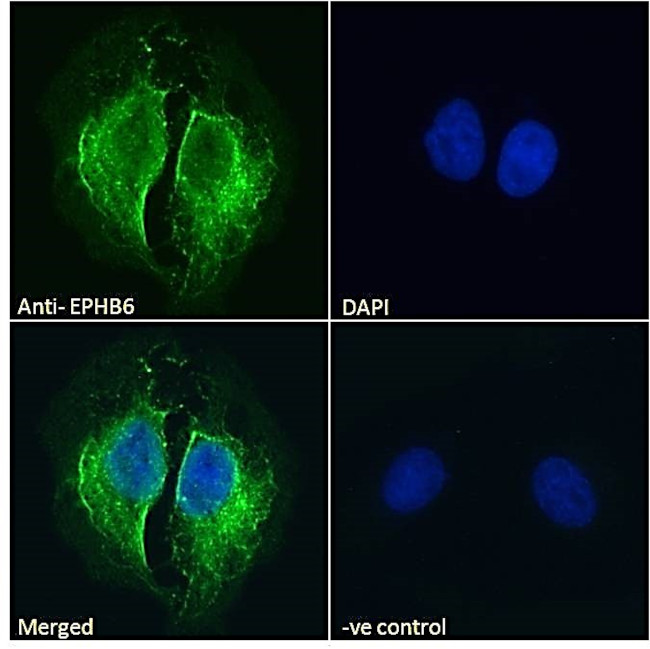 EphB6 Antibody in Immunocytochemistry (ICC/IF)