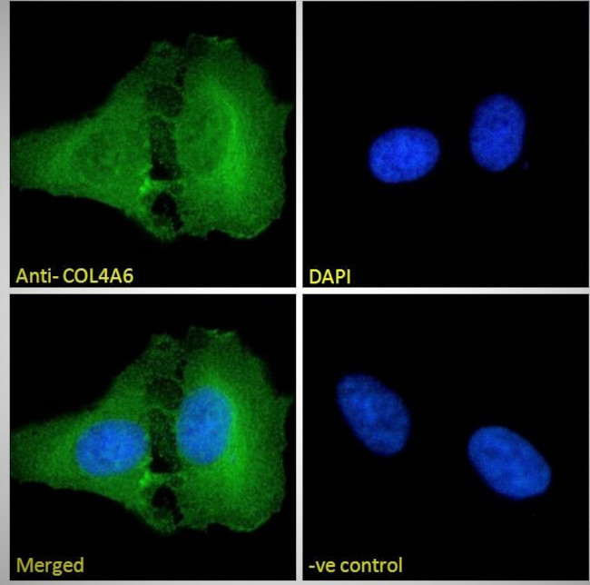 COL4A6 Antibody in Immunocytochemistry (ICC/IF)