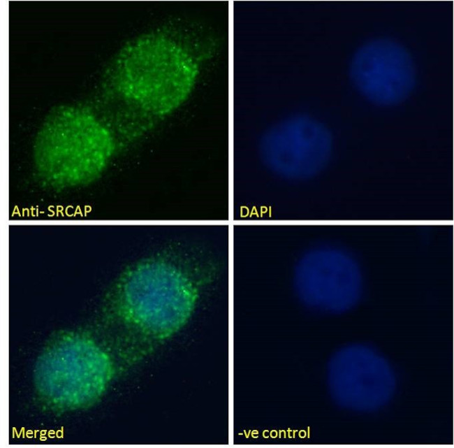 SRCAP Antibody in Immunocytochemistry (ICC/IF)