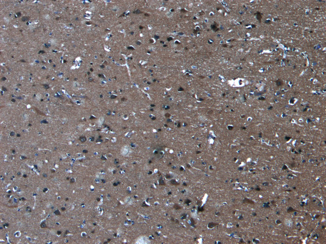 PCDH11X/PCDH11Y Antibody in Immunohistochemistry (Paraffin) (IHC (P))