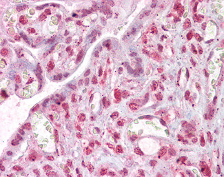 MLX Antibody in Immunohistochemistry (Paraffin) (IHC (P))