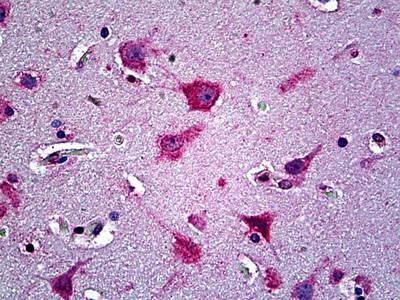 Ephrin A5 Antibody in Immunohistochemistry (Paraffin) (IHC (P))