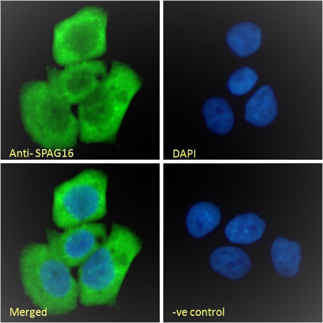 SPAG16 Antibody in Immunocytochemistry (ICC/IF)