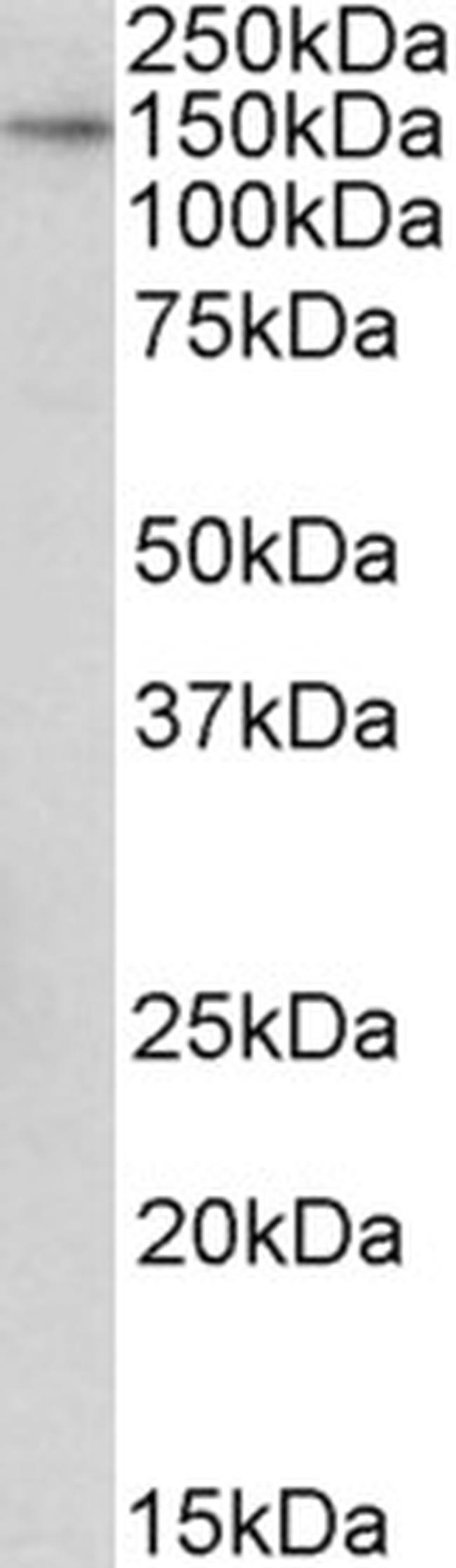 TTLL4 Antibody in Western Blot (WB)