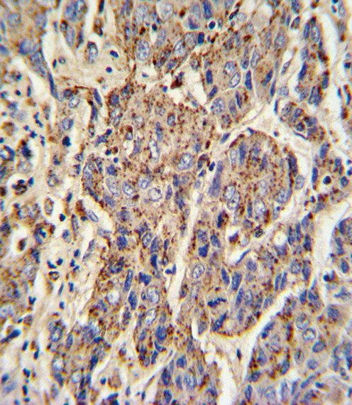 Cathepsin B Antibody in Immunohistochemistry (Paraffin) (IHC (P))