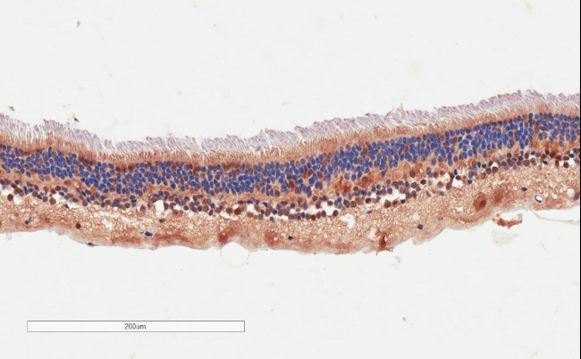 ARMS2 Antibody in Immunohistochemistry (Paraffin) (IHC (P))
