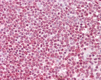FBXO4 Antibody in Immunohistochemistry (Paraffin) (IHC (P))