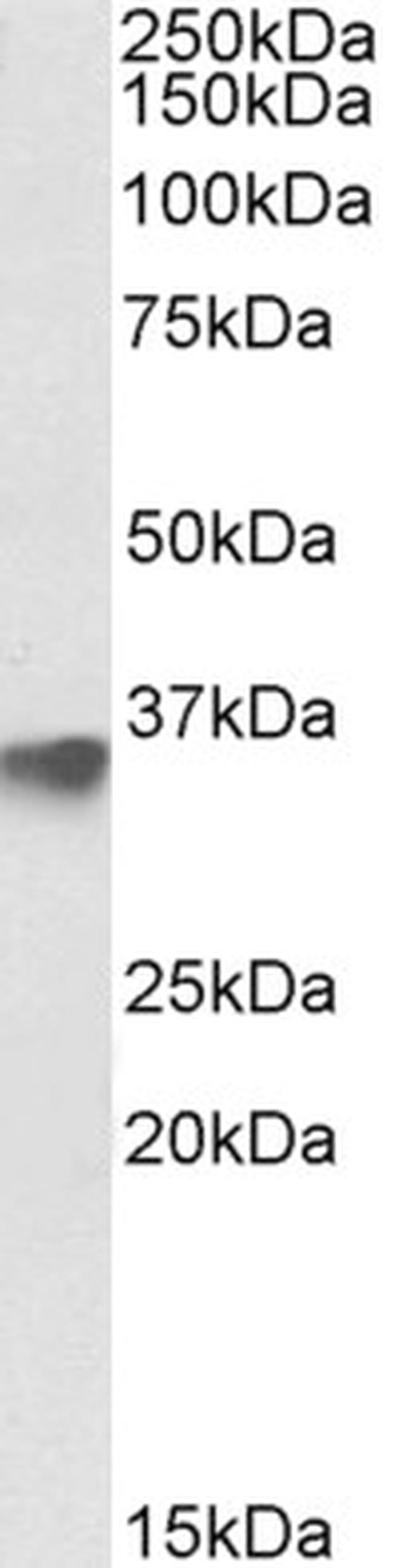 FBXO4 Antibody in Western Blot (WB)