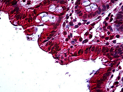 TAB2 Antibody in Immunohistochemistry (Paraffin) (IHC (P))
