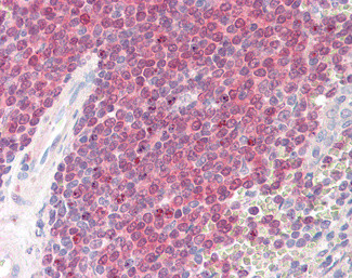 BOB-1 Antibody in Immunohistochemistry (Paraffin) (IHC (P))