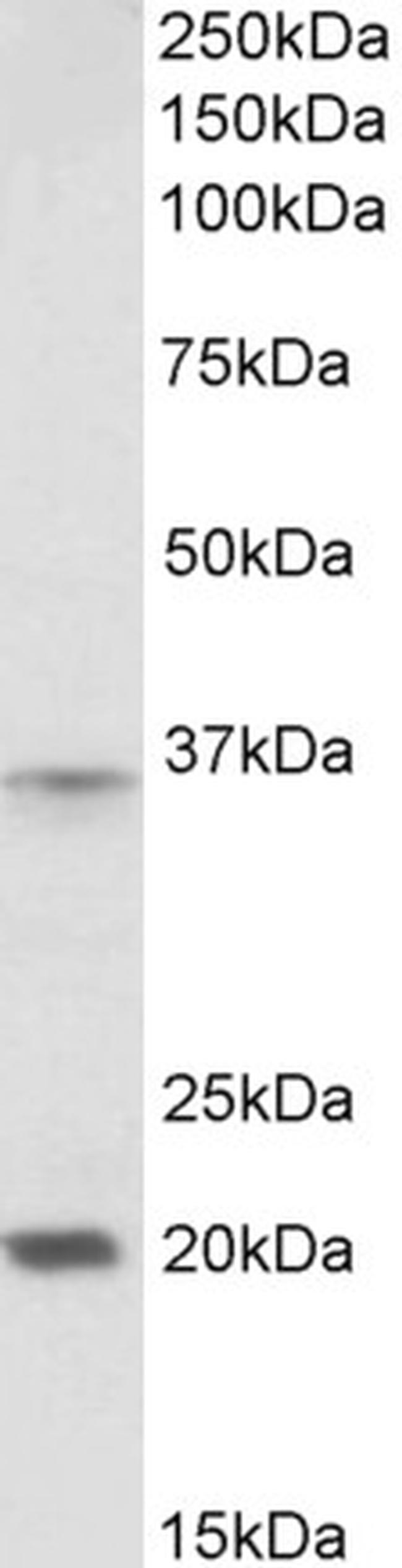 HOXA9 Antibody in Western Blot (WB)