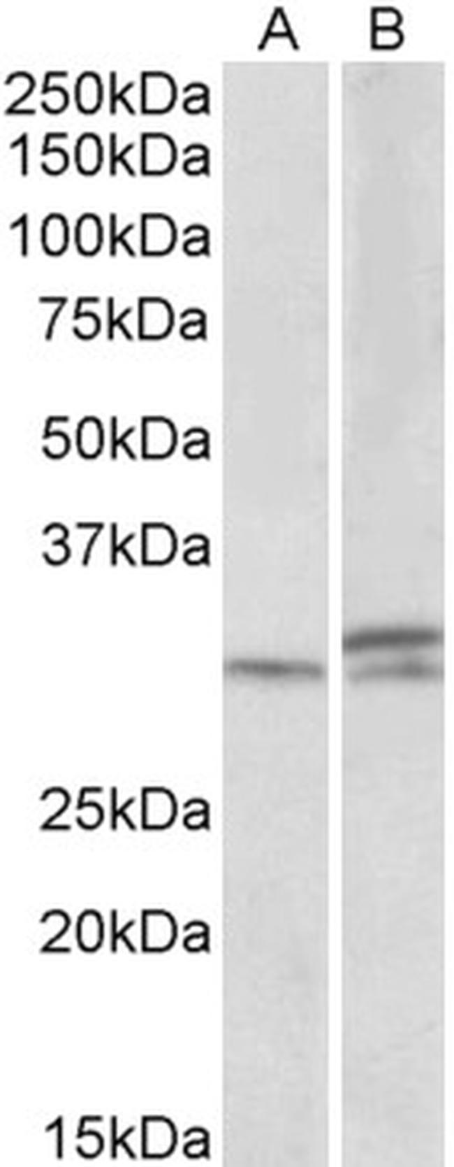 HOXA9 Antibody in Western Blot (WB)