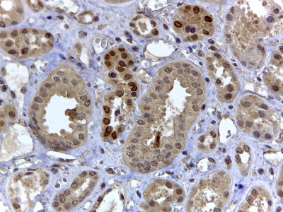 HIF3A Antibody in Immunohistochemistry (Paraffin) (IHC (P))