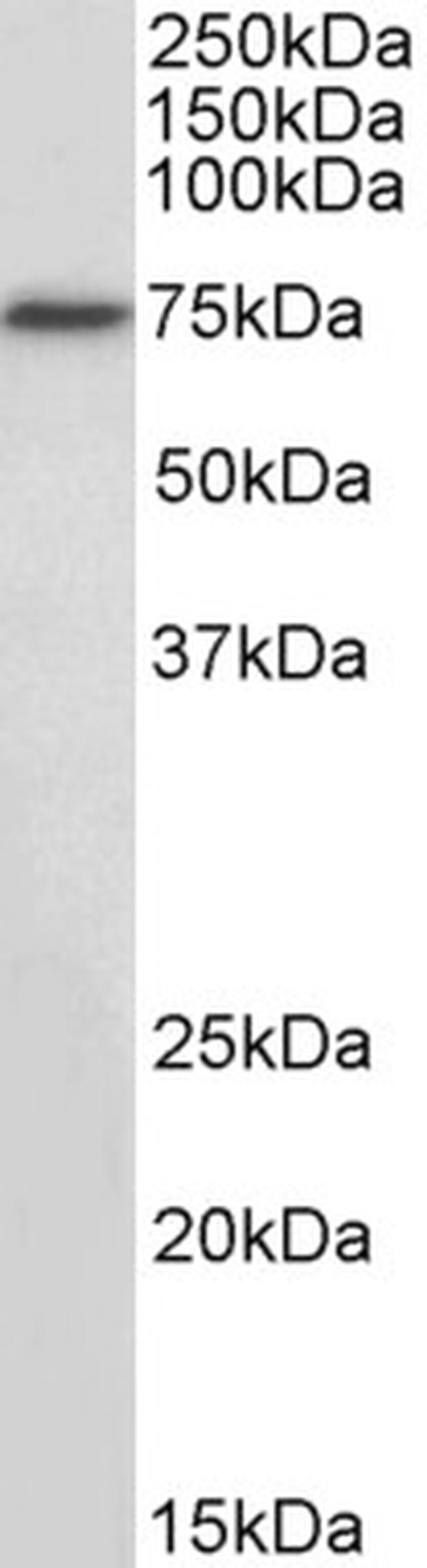 RFX5 Antibody in Western Blot (WB)