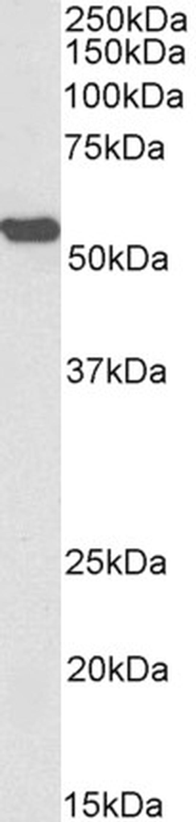 ALDH2 Antibody in Western Blot (WB)