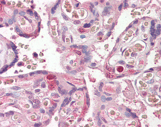 FANCE Antibody in Immunohistochemistry (Paraffin) (IHC (P))