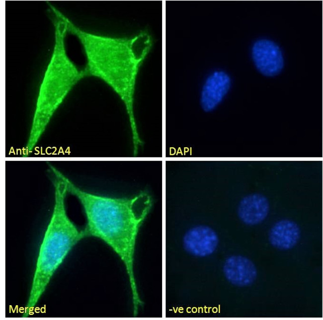 GLUT4 Antibody in Immunocytochemistry (ICC/IF)