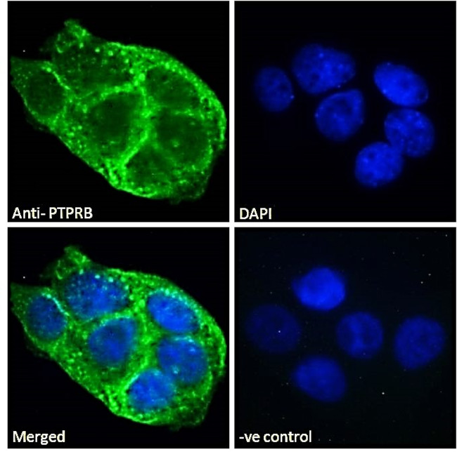 PTPRB Antibody in Immunocytochemistry (ICC/IF)