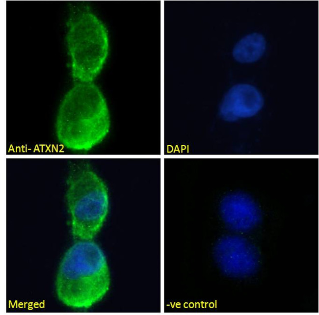 Ataxin 2 Antibody in Immunocytochemistry (ICC/IF)
