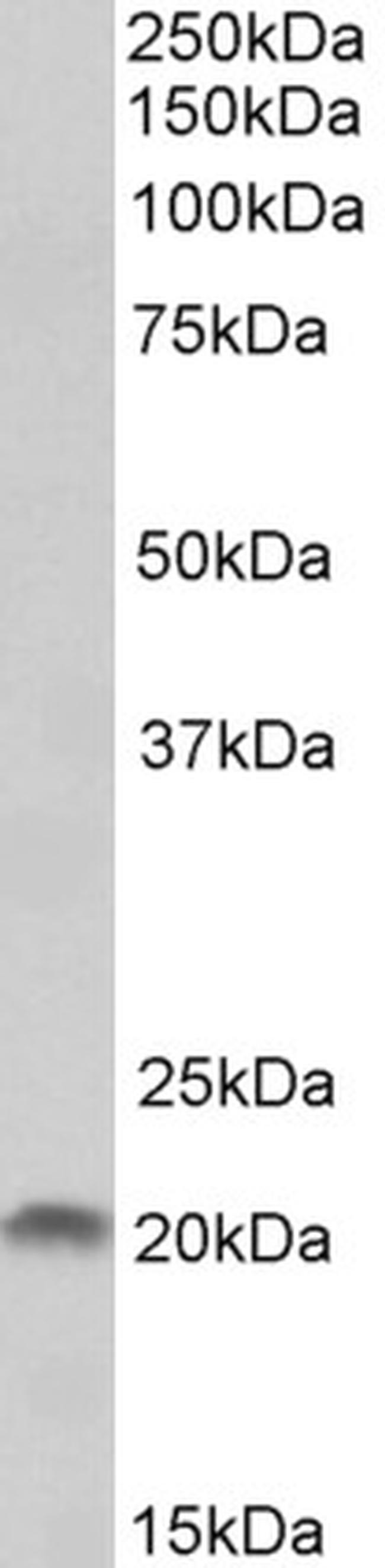 HAI-2 Antibody in Western Blot (WB)