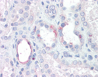 RHBG Antibody in Immunohistochemistry (Paraffin) (IHC (P))