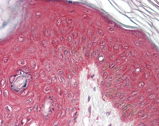 PSMB4 Antibody in Immunohistochemistry (Paraffin) (IHC (P))