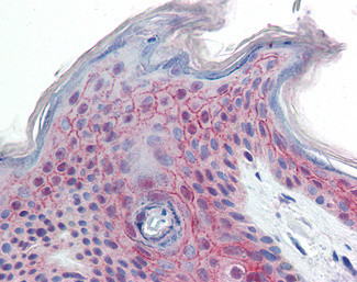 PNAS4 Antibody in Immunohistochemistry (Paraffin) (IHC (P))