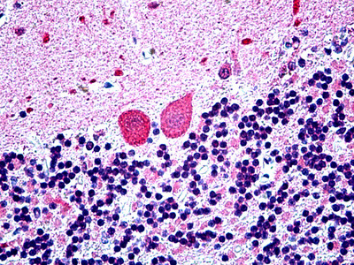 WBP1 Antibody in Immunohistochemistry (Paraffin) (IHC (P))
