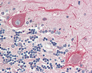 BCL2L15 Antibody in Immunohistochemistry (Paraffin) (IHC (P))