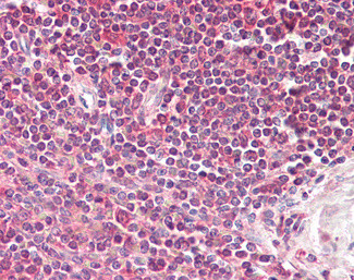 LIMS2 Antibody in Immunohistochemistry (Paraffin) (IHC (P))