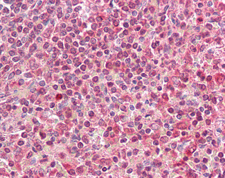HLA-DQA2 Antibody in Immunohistochemistry (Paraffin) (IHC (P))