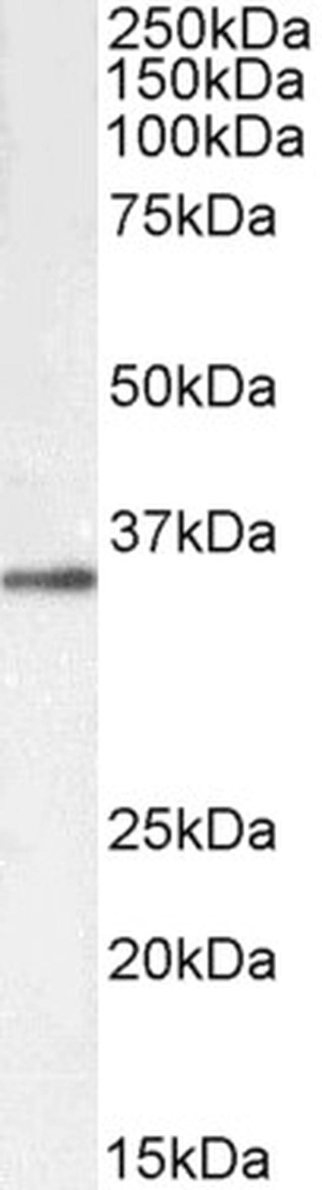 GNB3/GNB4 Antibody in Western Blot (WB)