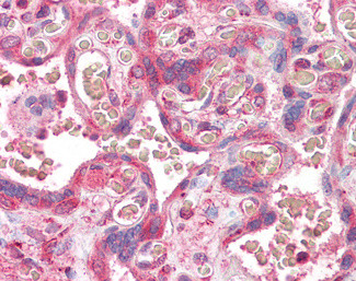 ERV3 Antibody in Immunohistochemistry (Paraffin) (IHC (P))