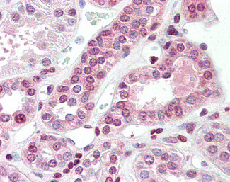 TGM7 Antibody in Immunohistochemistry (Paraffin) (IHC (P))